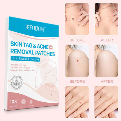 Patch visage anti-acné et boutons noirs, stickers de soin invisibles pour éliminer les imperfections de la peau.