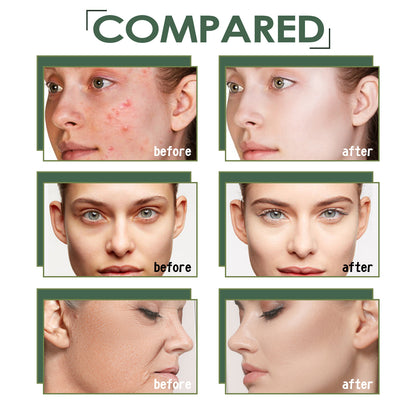 Peau éclatante avec des marques d&